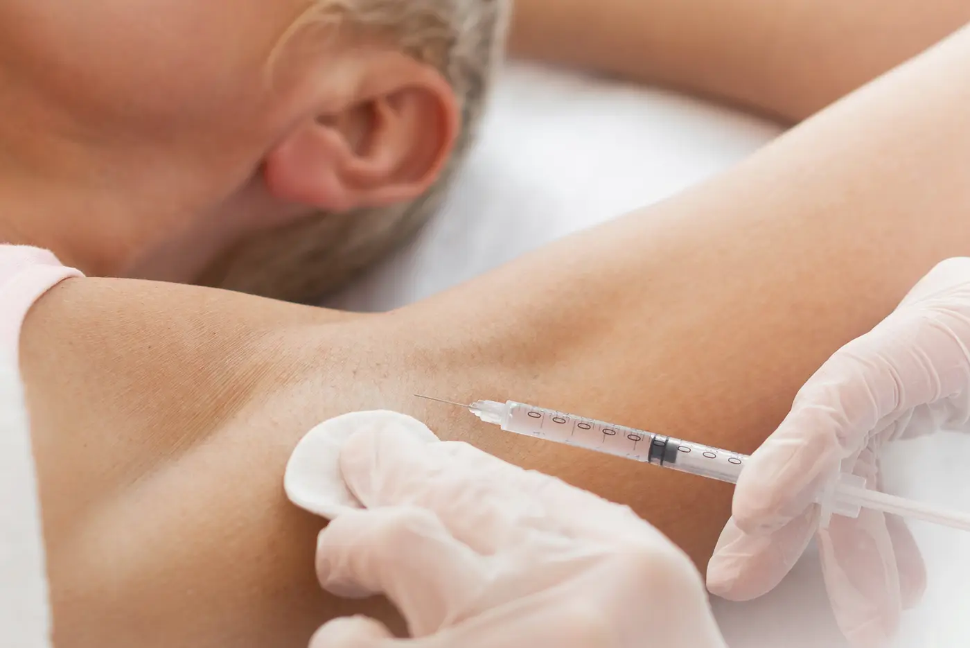 Excessive Sweating Treatment