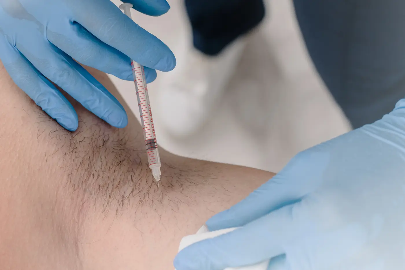 Hyperhidrosis treatments